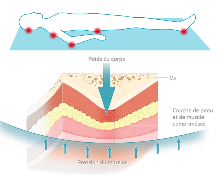 Effet des forces de pression