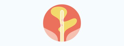 Why does urethral and bladder microtrauma occur?