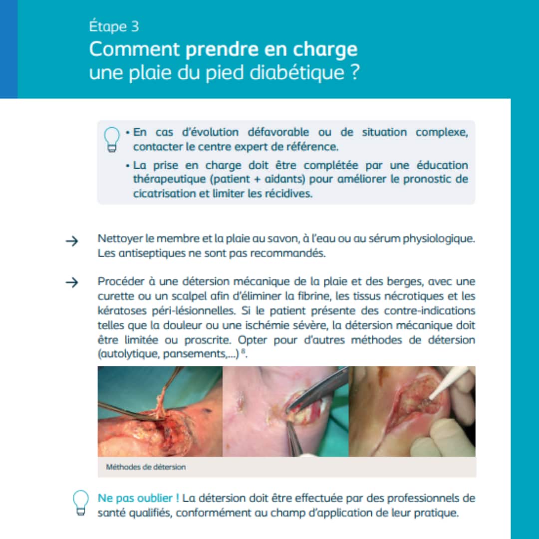 Comment prendre en charge?